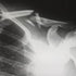 Cuidados en traumatología y Rehabilitacion - EducaCursos