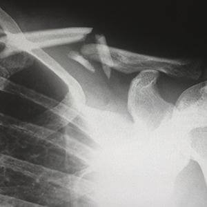 Cuidados en traumatología y Rehabilitacion - EducaCursos
